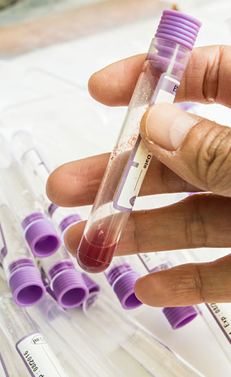 Bloodwork Testing