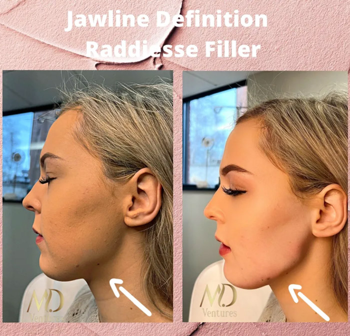 Before & After Gallery